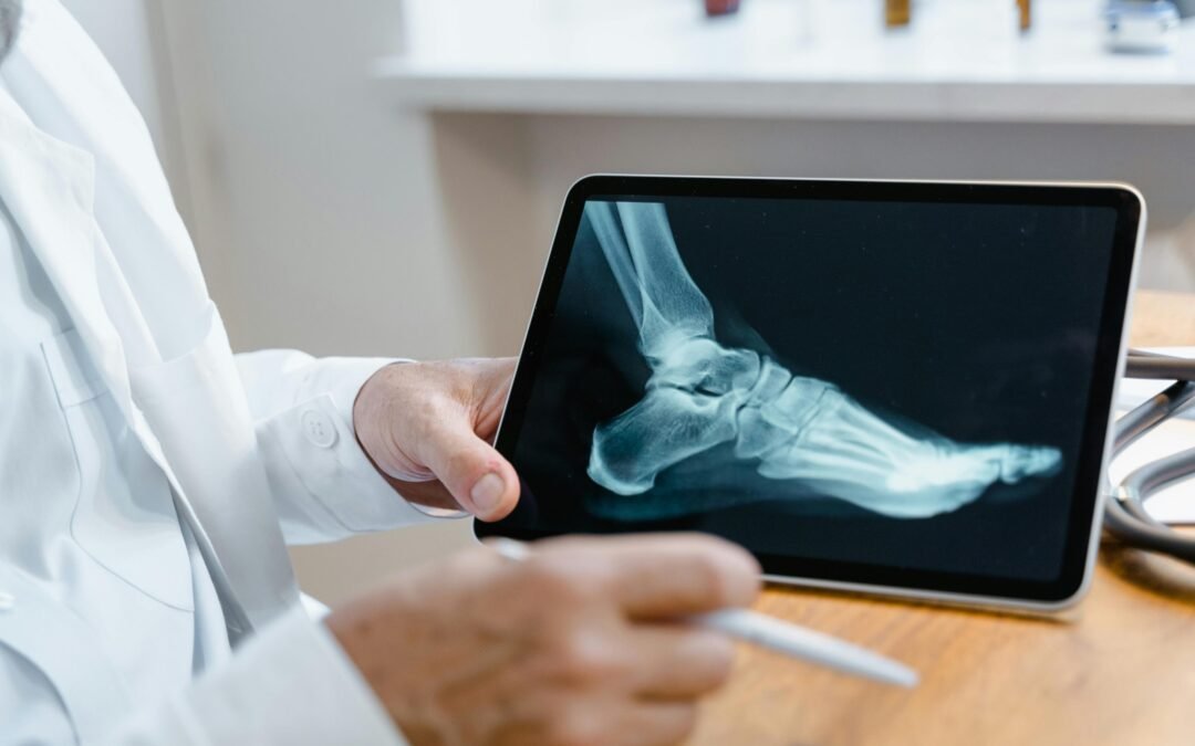 Más de 100 urgencias ortopédicas al día: un llamado a la prevención